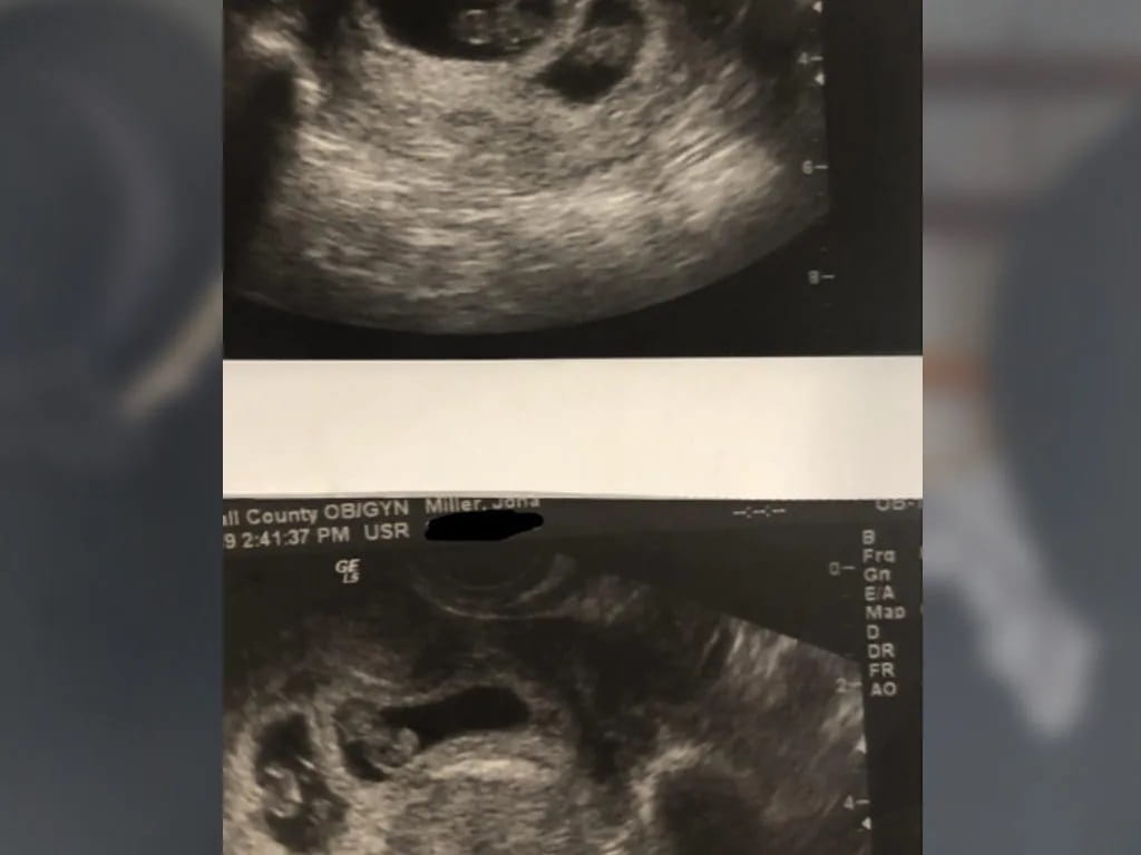 They Are Expecting Twins