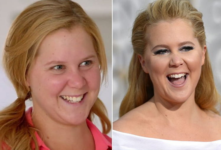 Amy Schumer