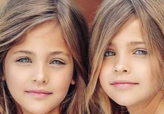 Sie Galten Als Die Schönsten Zwillinge Der Welt Aber Was Wurde Aus Den Bildhübschen Mädchen 