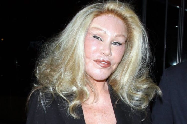 Jocelyn Wildenstein