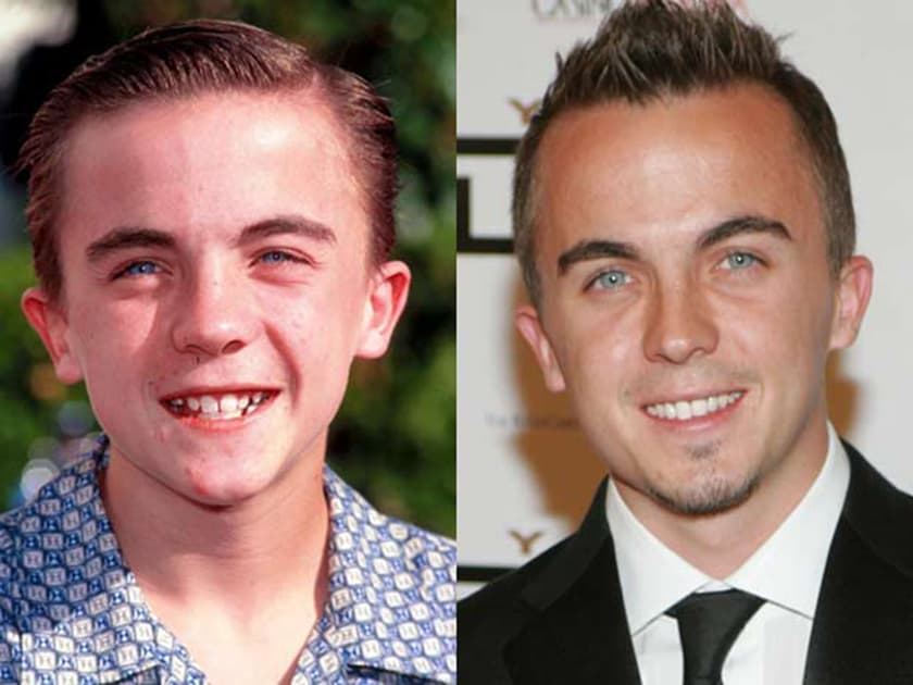 Frankie Muniz