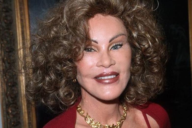 Jocelyn Wildenstein Then