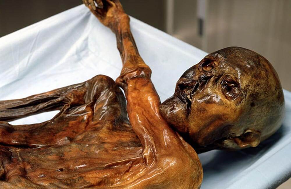 Ötzi The Iceman