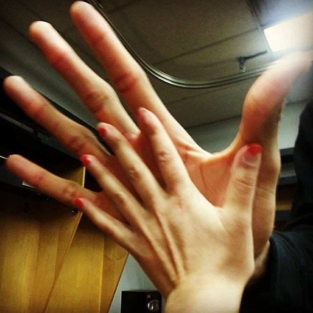 The Hand Of NBA Player Vs. Average Hand
