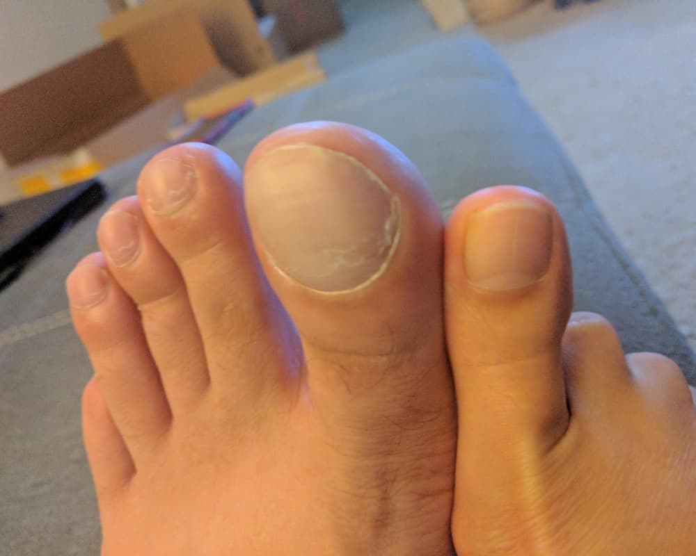 Husband's Big Toe Vs. Wife's Big Toe