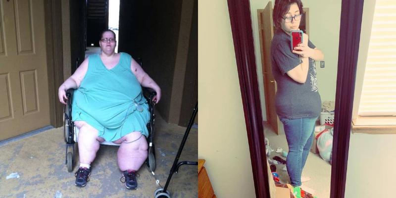 'My 600-Lb Life' Before and After Photos — Where Are They Now? | Xfreehub