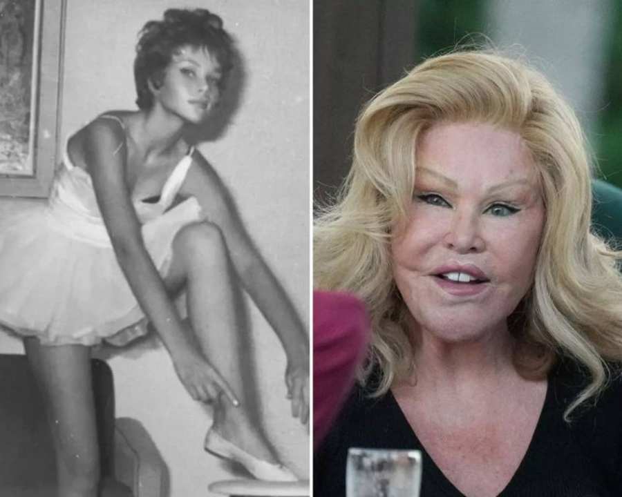 Jocelyn Wildenstein 82 Ans