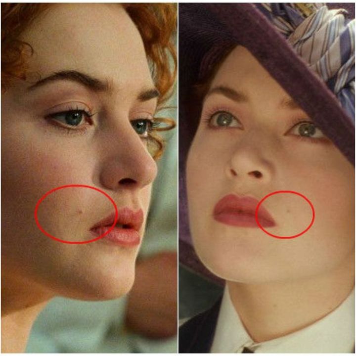 Rose’s Beauty Mark Changes Sides